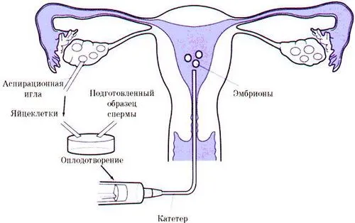 першого