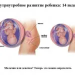 5 тижнів вагітності коричневі виділення