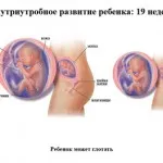 позаматкова вагітність 5 тижнів