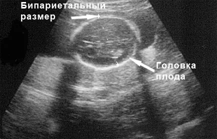 розвиток і ворушіння плода на вісімнадцятій тижня вагітності