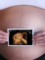 18 тиждень вагітності руху дитини