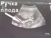 харчування вагітної жінки