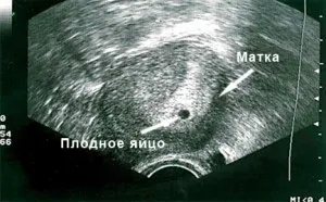 4 тиждень вагітності