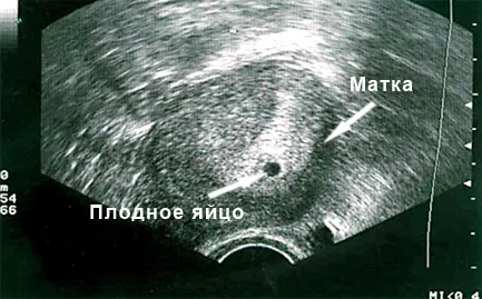 харчування вагітної жінки