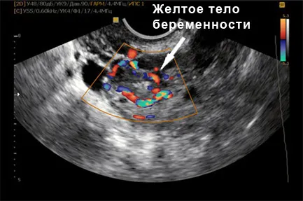 розвиток ембріона