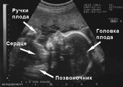 виділення