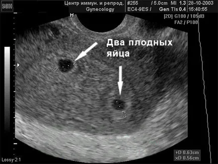 харчування вагітної жінки
