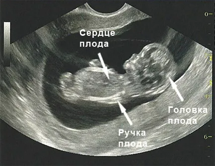 болі внизу живота