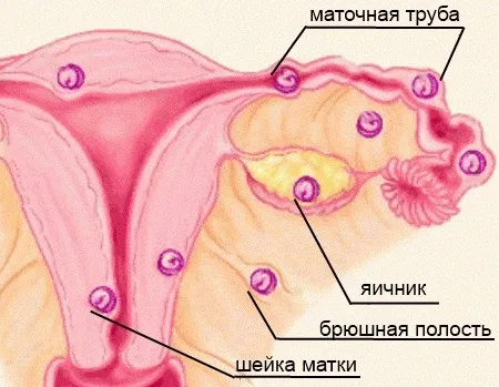 яка базальна температура при позаматкової вагітності