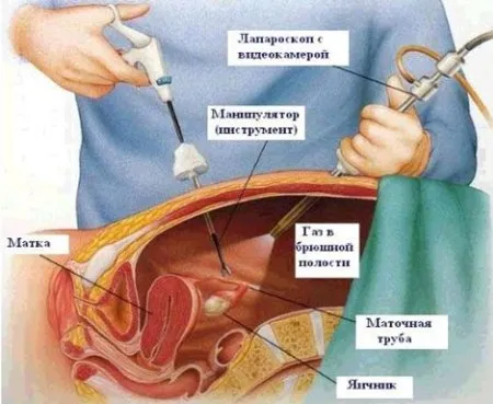 яка базальна температура при позаматкової вагітності