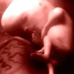 Четвертий місяць вагітності 17