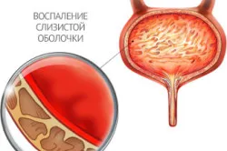 перший по підлозі
