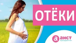 набряки ніг під час вагітності