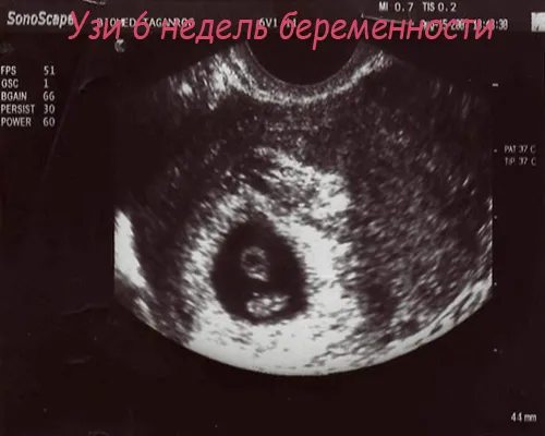 все про вагітність від а до я