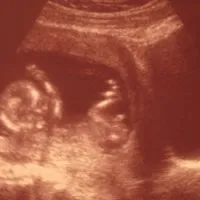 13 тиждень вагітності руху дитини