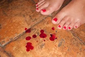 коричневі виділення під час вагітності на ранніх термінах