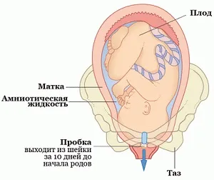 як виглядає пробка перед пологами