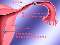 порожнини