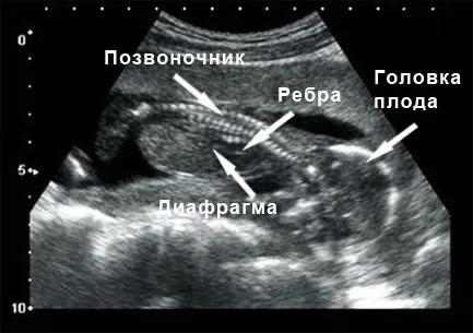16 тиждень вагітності виділення