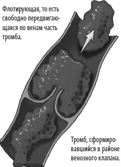 як лікувати аритмію
