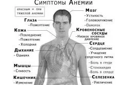 лікування