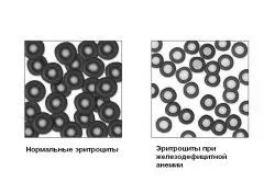 симптоми