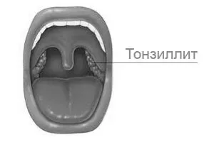 симптоми