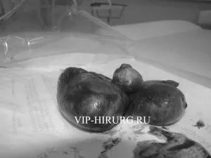 лікування