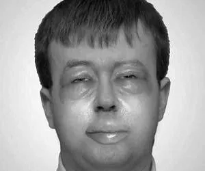 алергія на обличчі лікування