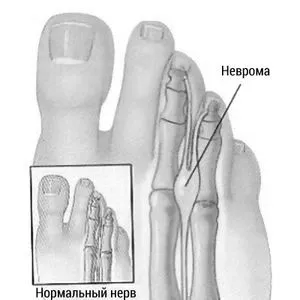 лікування