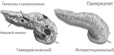 таблетки