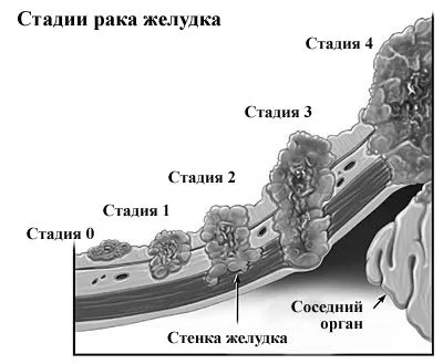 умовах