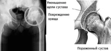 тазостегнового