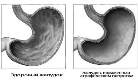 симптоми