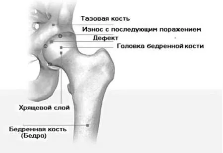 тазостегнового
