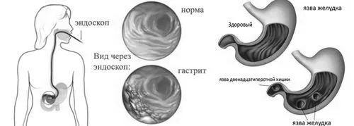 таблетки