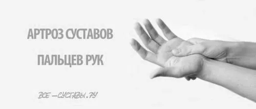 Артроз суглобів пальців рук як лікувати артроз суглобів пальців рук