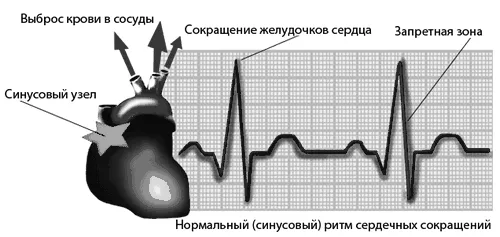 як лікувати аритмію