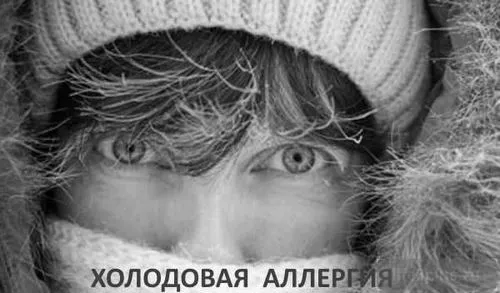 кропив'янка