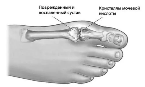 великого