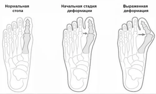 великого