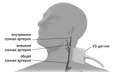 лікування