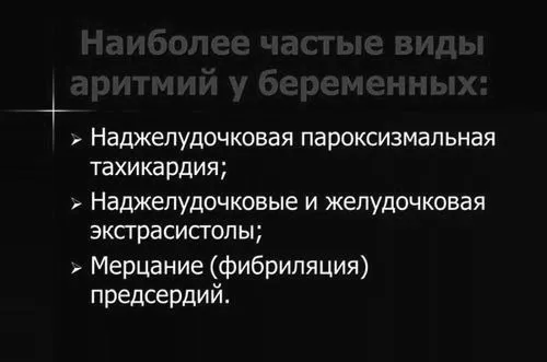 Аритмія при вагітності - причини, симптоми, лікування, що робити, чим небезпечна, на ранніх, пізніх термінах як лікувати аритмію при вагітності