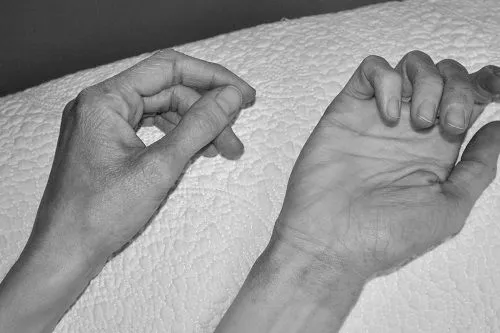 Алергія на холод на руках як лікувати алергію на холод на руках