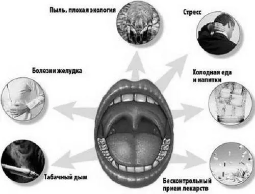 лікувати алергічний фарингіт