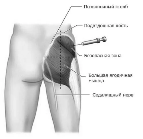 назва