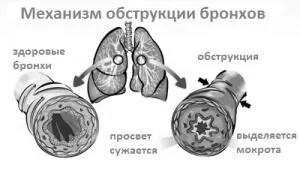 лікування