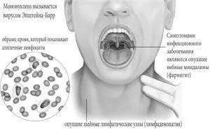 цитомегаловірус