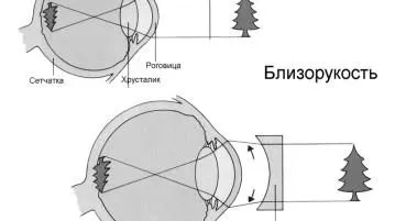 окуляри