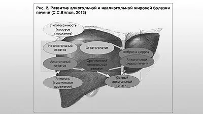 стеатоз